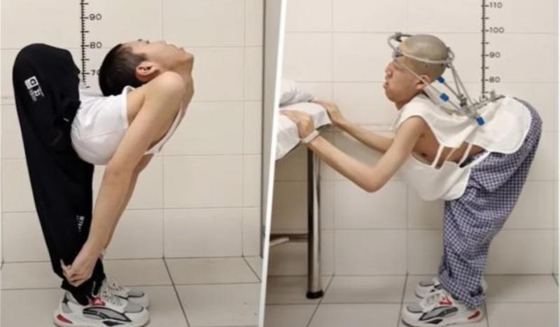 Fotomontagem com menino de coluna dobrada