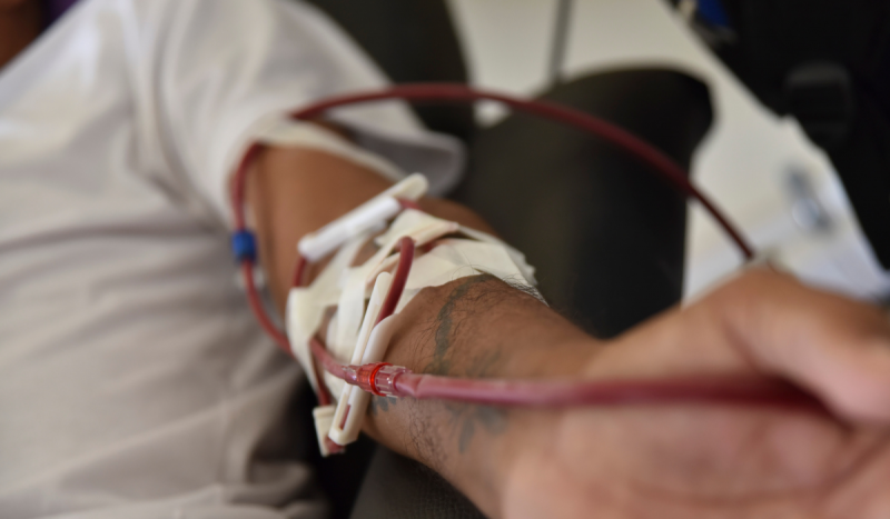 Braço de paciente fazendo hemodiálise