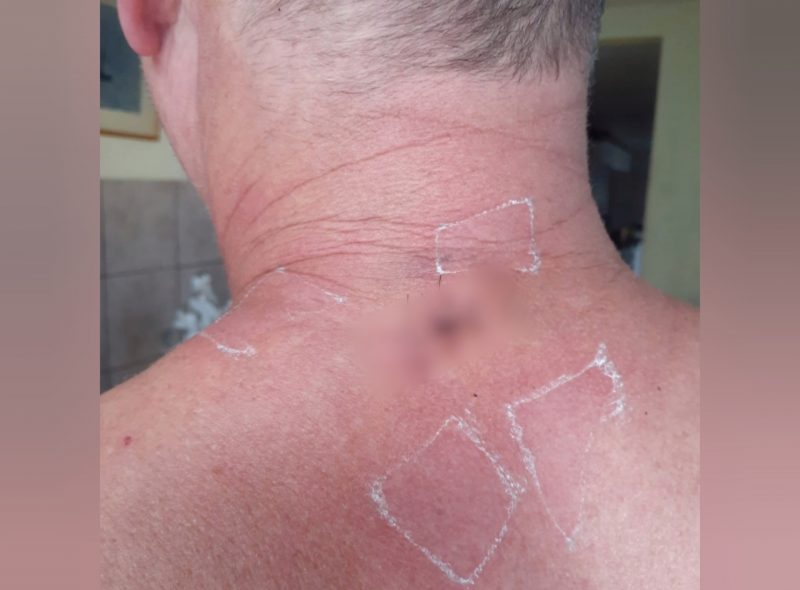 V&iacute;tima foi esfaqueada na nuca – Foto: Reprodu&ccedil;&atilde;o/ND