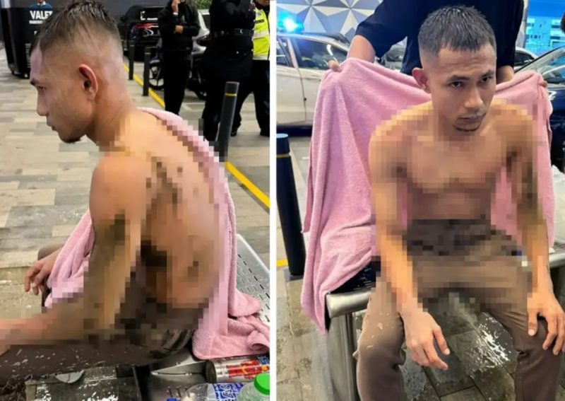 Jogador atacado com ácido