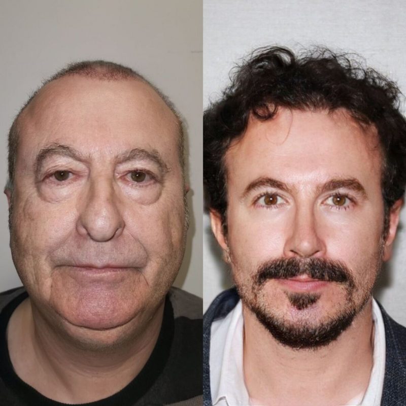 uma das cirurgias faciais da clínica foi supostamente realizada no paciente michael