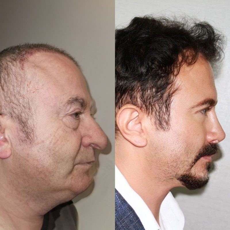 paciente michael muito diferente