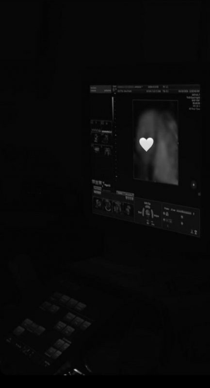 M&atilde;e da poss&iacute;vel nova filha do craque postou uma foto do ultrassom – Foto: Divulgado na Internet/Reprodu&ccedil;&atilde;o/ND