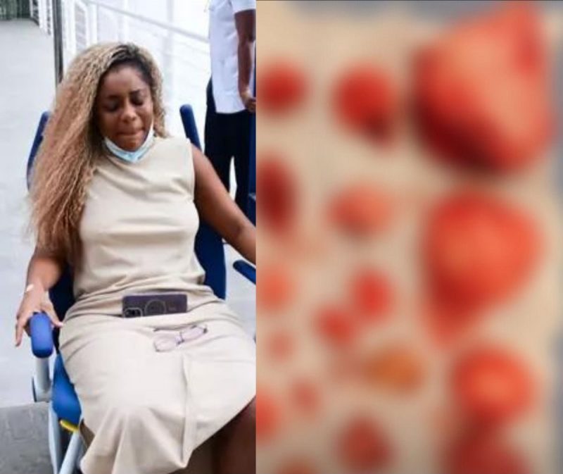 Apresentadora mostra os 17 miomas que foram retirados do seu útero: 'pareciam cachos de uvas'