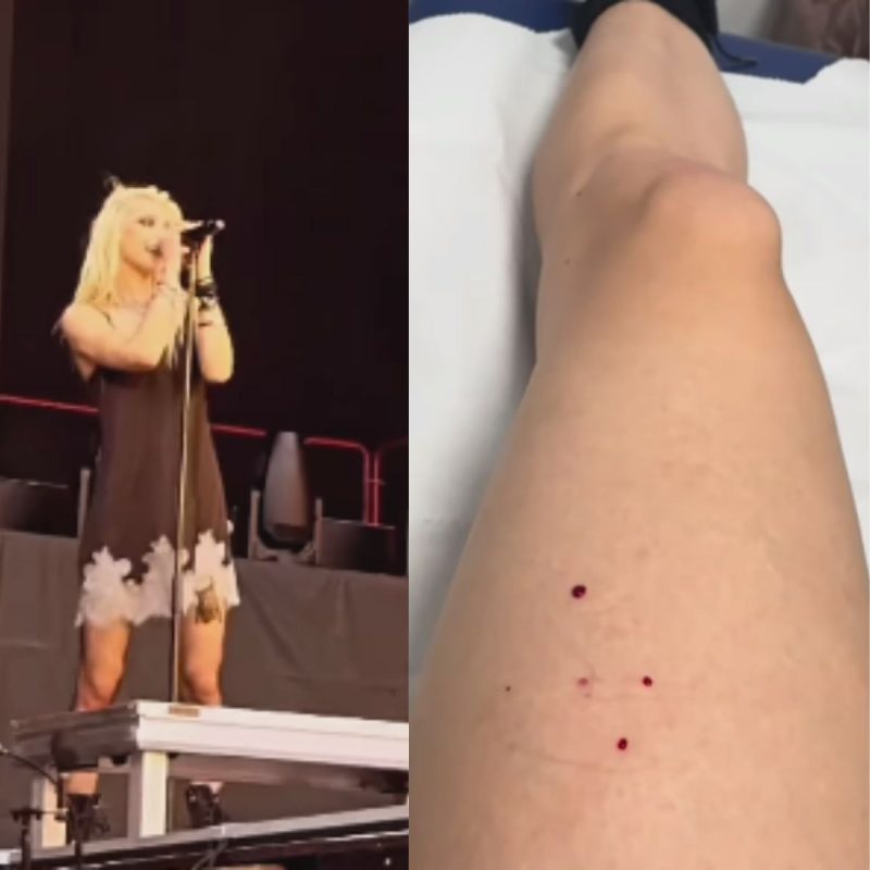Cantora &eacute; mordida por morcego durante apresenta&ccedil;&atilde;o – Foto: Divulgado na Internet/Reprodu&ccedil;&atilde;o/ND