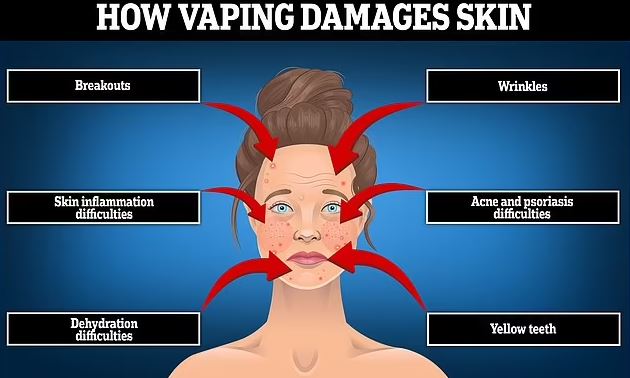 Vape Face: Ilustra&ccedil;&atilde;o dos danos do vape na pele – Foto: Daily Mail/ND