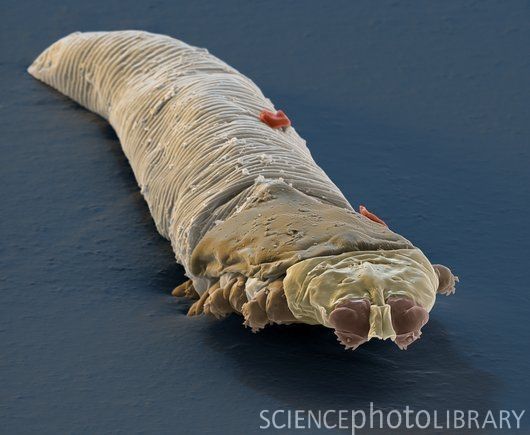 N&atilde;o &eacute; recomend&aacute;vel e nem poss&iacute;vel remover todos os &aacute;caros nos c&iacute;lios – Foto: Reprodu&ccedil;&atilde;o/ND