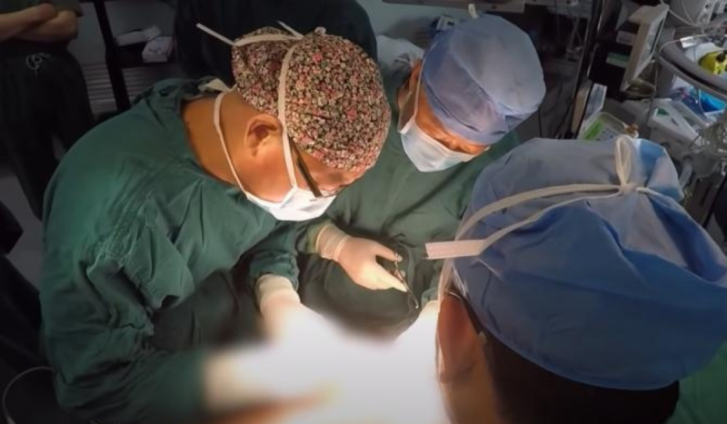 Médicos com roupas cirúrgicas verdes fazendo cirurgia para remover tumor no útero de paciente. Eles também usam toucas na cor azul. 