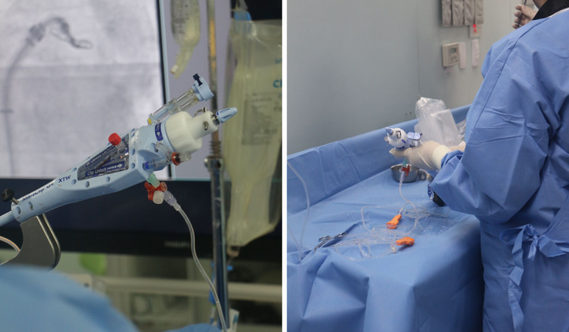 Aparelho moderno usado para cirurgia no coração. Fotomontagem tem duas fotos, à direita um médico com roupa azul segura balão transparente e à esquerda um equipamento semelhante a uma pistola aponta para a direita