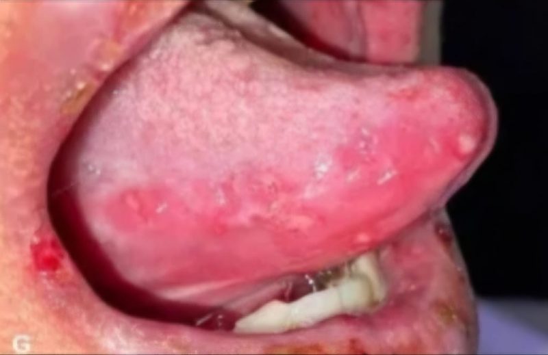 Condi&ccedil;&atilde;o incomum afeta menos de 1% da popula&ccedil;&atilde;o – Foto: ncbi.nlm.nih.gov/ND