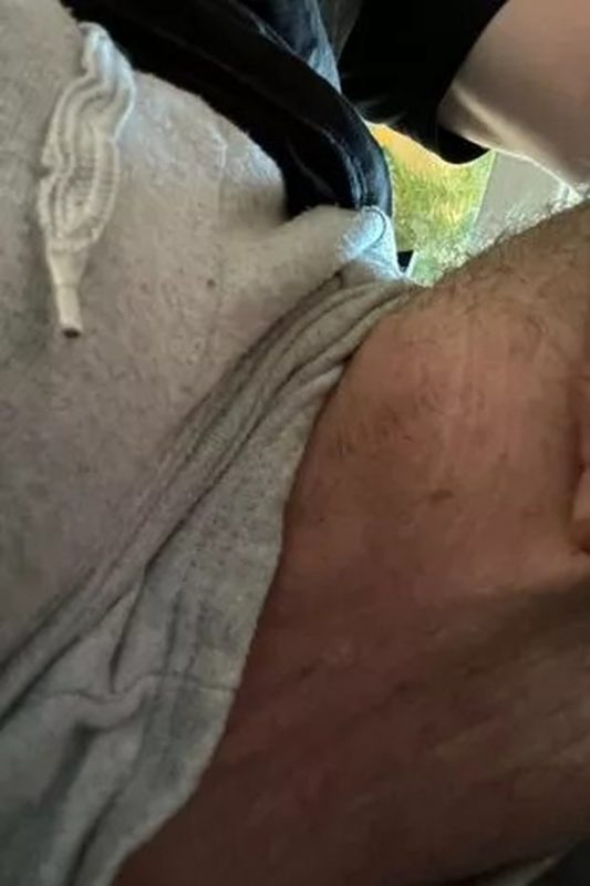 Tentativa de apimentar relação sexual resultou em manchas permanentes