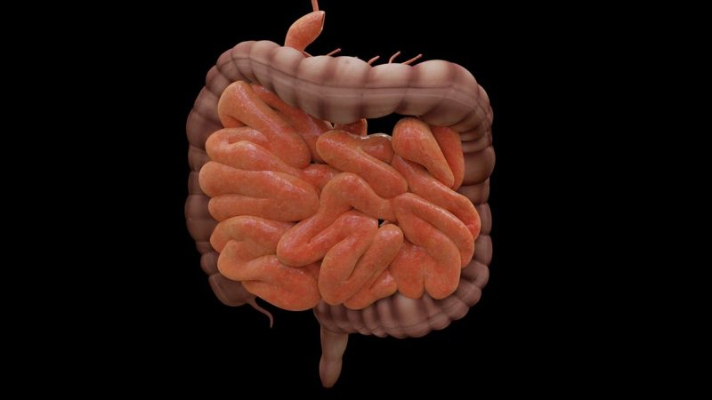 Na foto aparece um intestino, que é a parte do corpo humano que a doença de Crohn ataca.