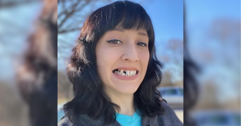Mulher decide perder os dentes