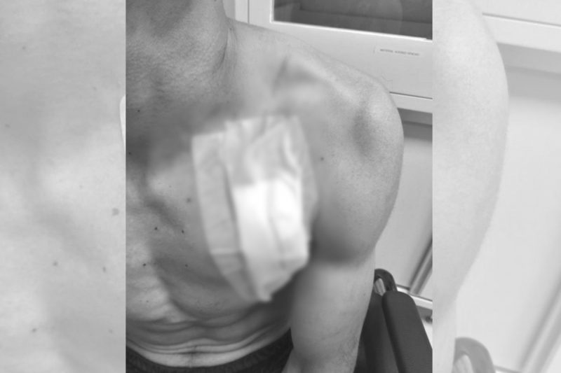 Homem foi preso no hospital por ter mandado de pris&atilde;o ativo por crimes de viol&ecirc;ncia sexual. – Foto: Pol&iacute;cia Militar/Divulga&ccedil;&atilde;o/ND