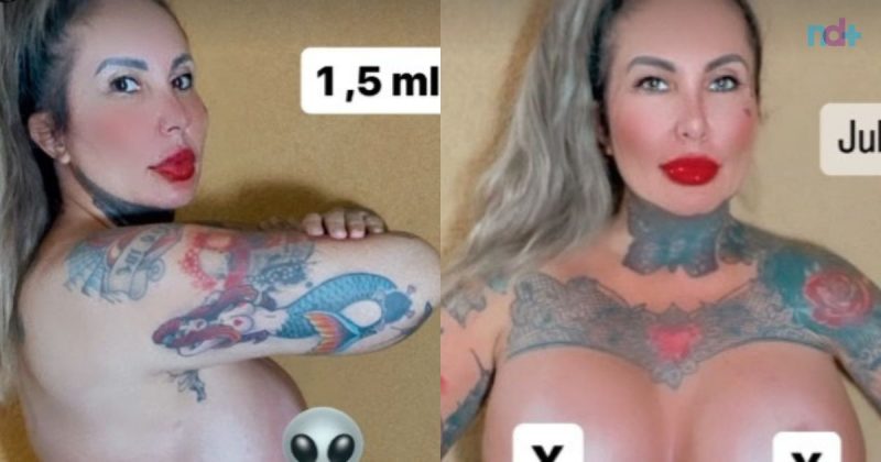 Sabrina Boing Boing aparece depois da cirurgia nos seios