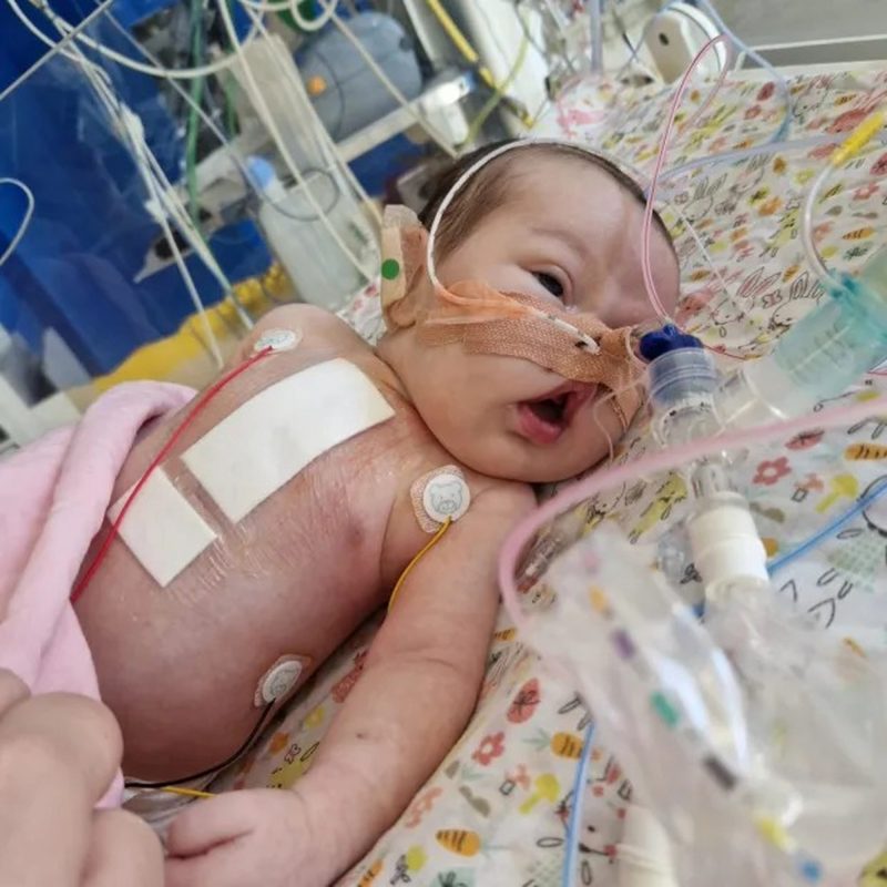 Hope recebeu Viagra quando tinha cinco semanas