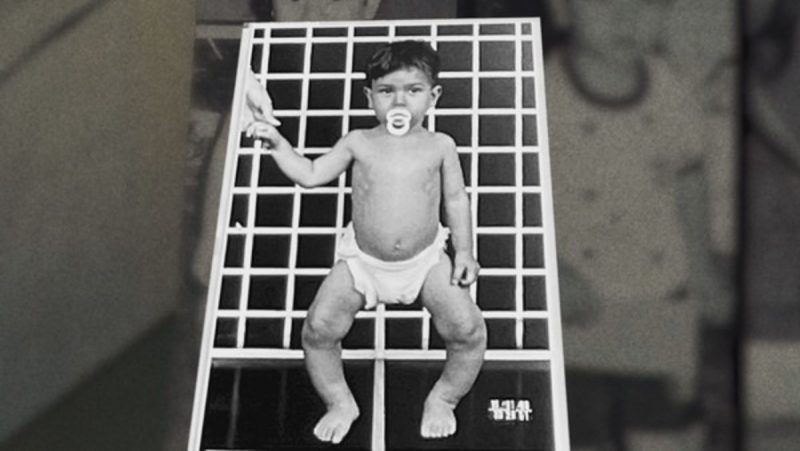 Caio Bonfim teve meningite aos 7 meses