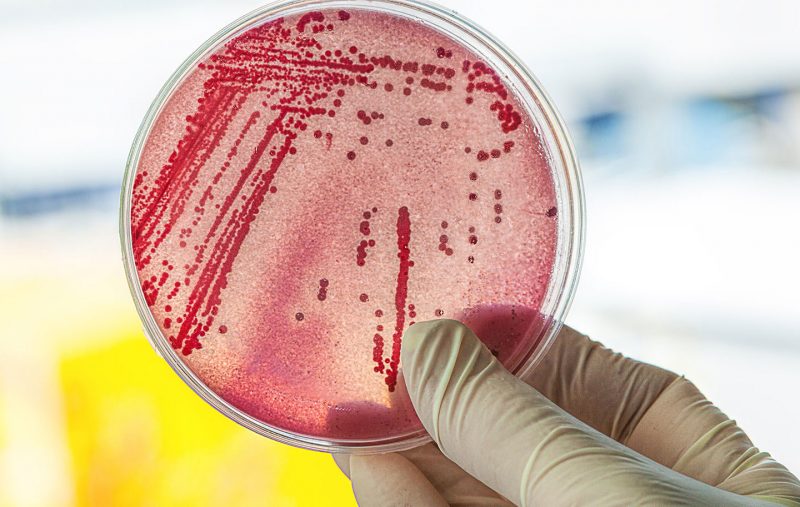 Foto mostra as bactérias de e. coli 