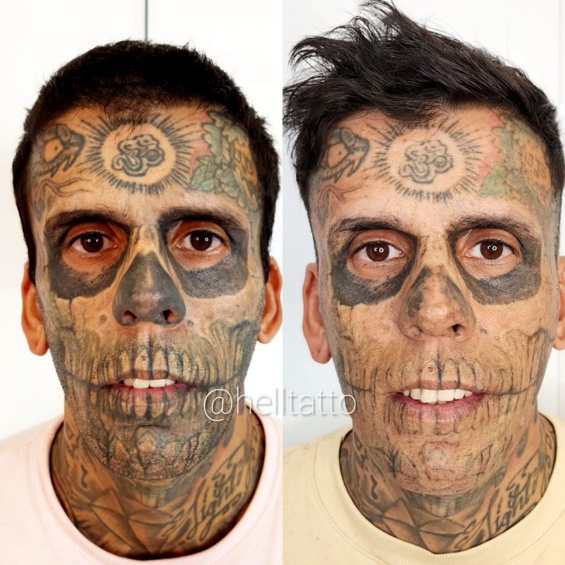 Antes e depois da segunda sessão de laser do homem mais tatuado do Brasil - Foto: Reprodução/Instagram