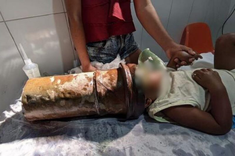 Menino de 2 anos com a cabeça presa em tubo de aço, em Alagoas