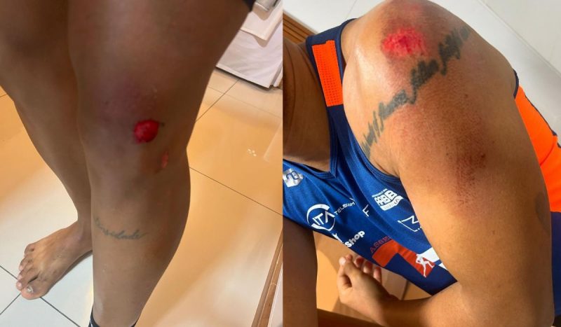 Motorista embriagado invadiu área dos atletas e acertou corredor; ele sofreu apenas hematomas – Foto: Instagram/Reprodução/ND