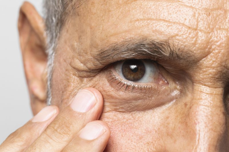 Homem checando a saúde dos olhos