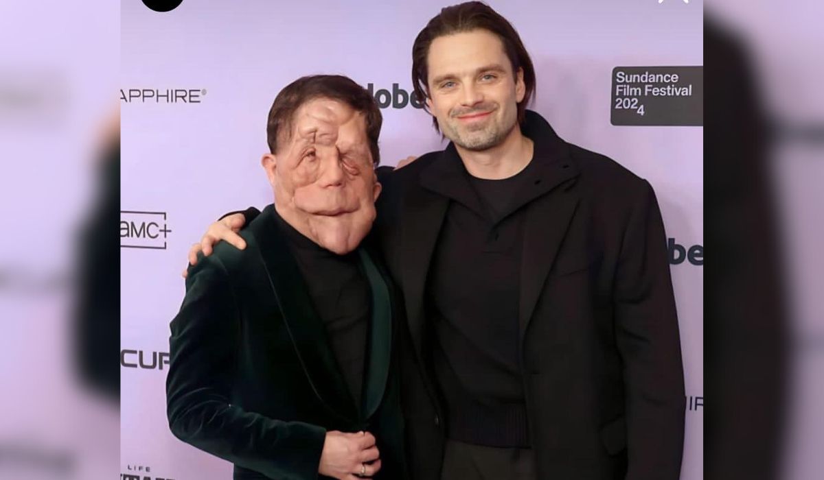 Adam (esquerda) e Sebastian Stan (direita) estrelam o filme A Different Man, lançado este ano - Instagram @adam_pearson_tv/Reprodução/ND