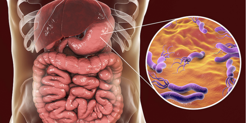 Imagem ilustrativa da bactéria Helicobacter pylori no estômago