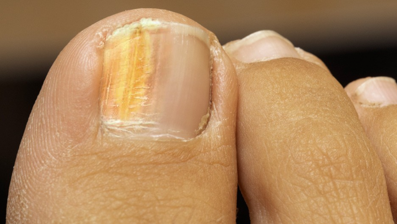 Vinagre de ma&ccedil;a &eacute; aliado no combate &agrave; infec&ccedil;&otilde;es – Foto: Reprodu&ccedil;&atilde;o/ND