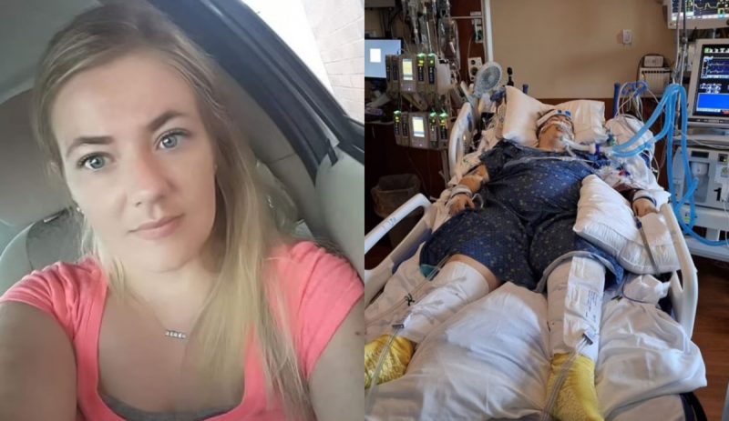 Mulher viciada em vape precisou ficar em coma por 11 dias 