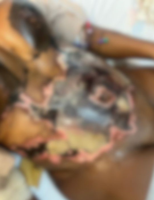 Letícia Mello sofreu lesões irreversíveis após cirurgias plásticas - Arquivo pessoal/ Reprodução/ ND