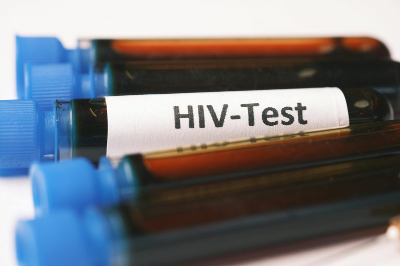 Frascos de sangue para teste de HIV 