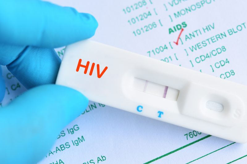 Casos de HIV aumentam no Brasil