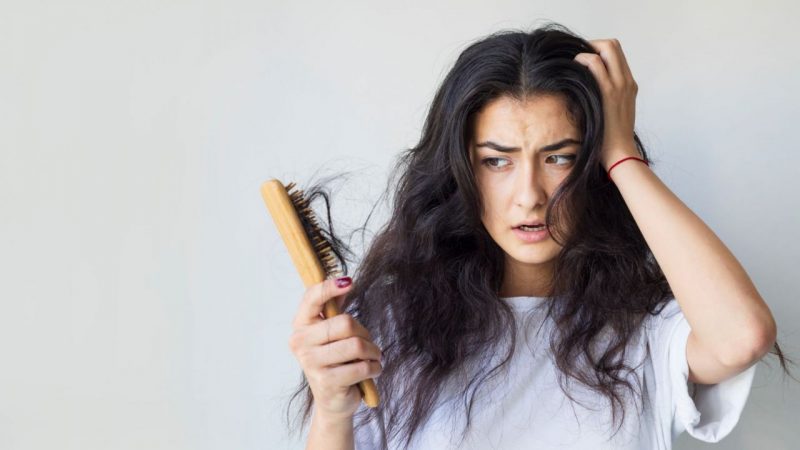 na foto aparece uma mulher com queda de cabelo após uso de produto 