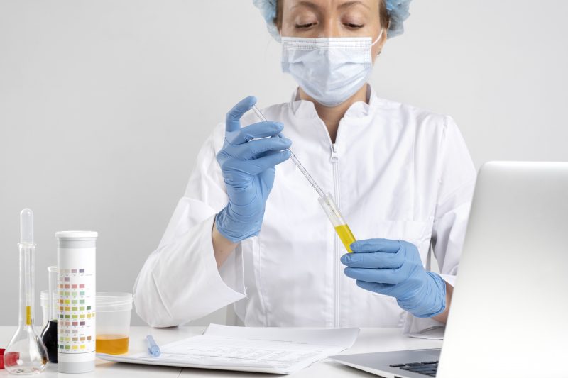 Urina Médica fazendo testes em um recipiente com urina