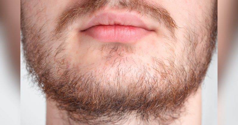 Imagem de barba masculina 