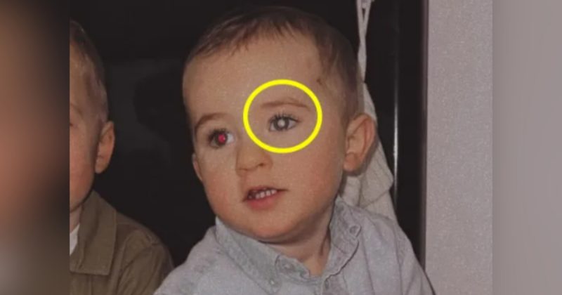 Imagem de bebê com os olhos diferentes