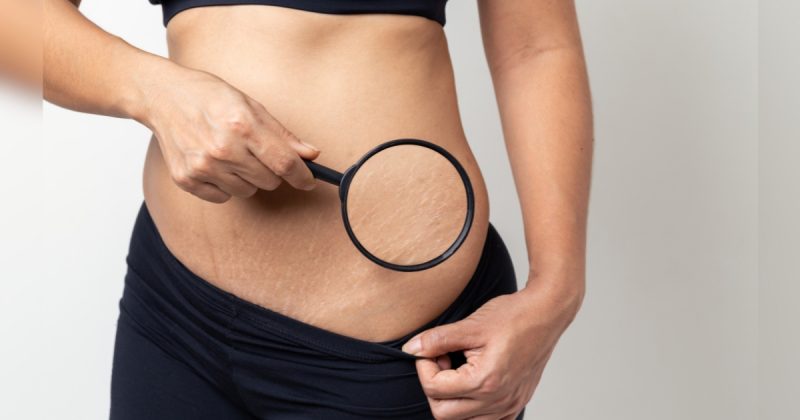 Pessoa com lupa em cima de pele