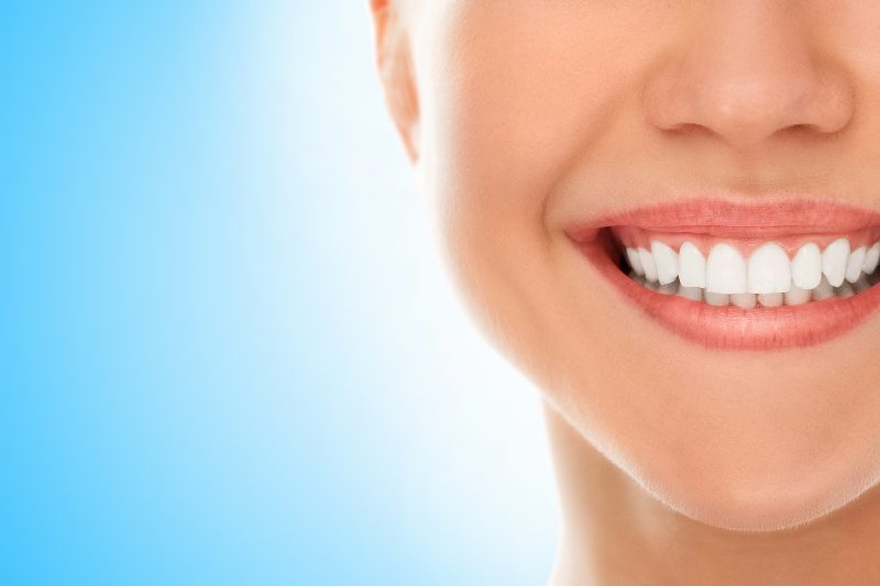 na foto aparece uma mulher sorrindo que aprendeu a clarear os dentes com receita caseira