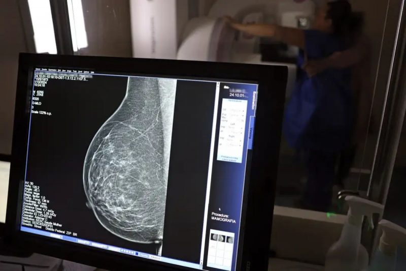 Mulher realiza mamografia pelo SUS