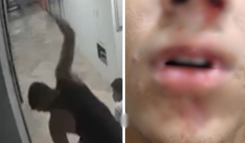 Rosto do garoto de 14 anos ficou bastante machucado