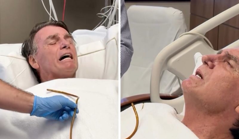 Bolsonaro retira sonda nasogástrica Bolsonaro retira sonda nasogástrica