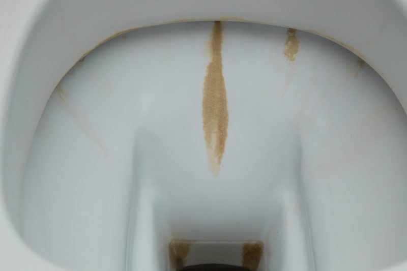Vaso sanitário encardido Vaso sanitário sujo com depósitos de manchas de calcário para representar como limpar vaso sanitário encardido