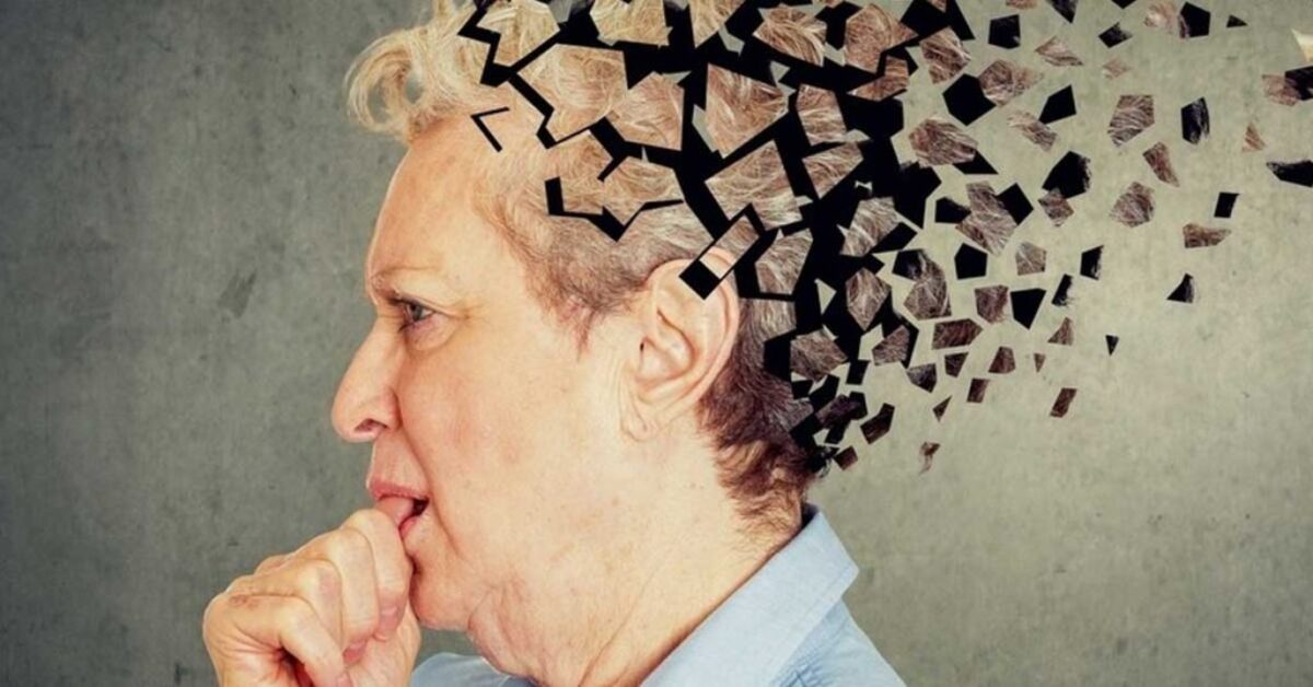 Mulher idosa com Alzheimer