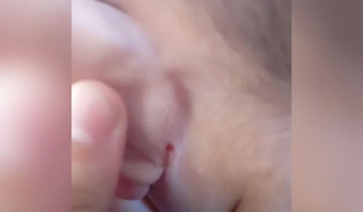 Foto do ferimento na orelha do bebê Bebê estava magro e com ferimentos na orelha
