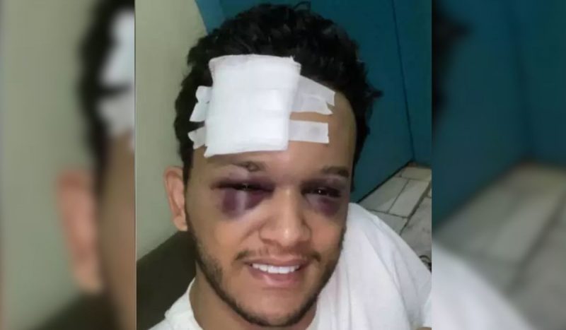 Cantor sertanejo Hugo sofre acidente de carro no Mato Grosso do Sul Cantor sertanejo Hugo sofre acidente de carro no Mato Grosso do Sul