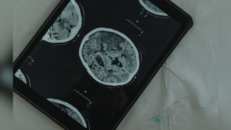 Ressonância magnética Imagem de cérebros dentro de celular imagem de ressonância magnética