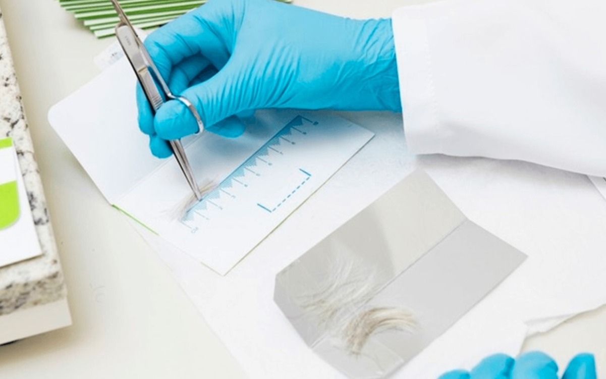 Amostras de cabelo, pelos ou unhas são coletados para identificar o uso de drogas ao longo de um período prolongado - Foto: Reprodução/ND
