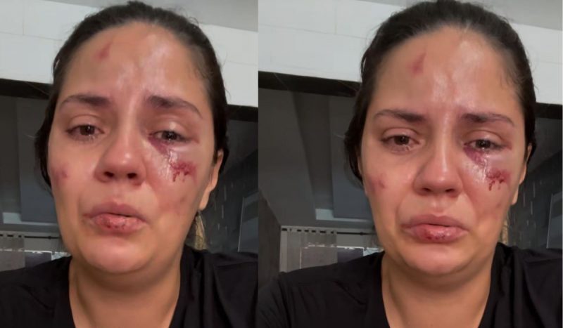 Jaqueline Nascimento sofreu cortes na cabeça e ferimentos no rosto Jaqueline Nascimento sofreu cortes na cabeça e ferimentos no rosto