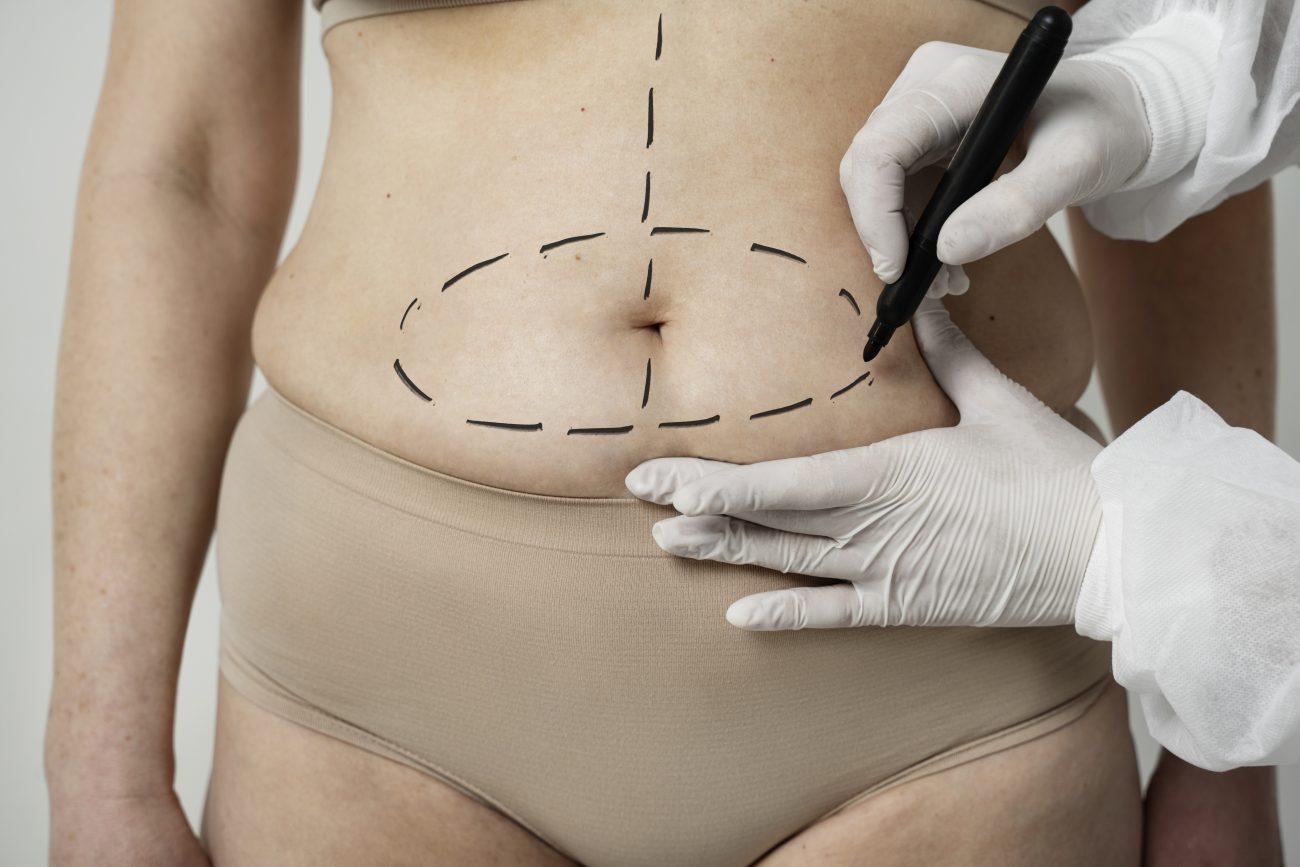 Pessoa com marcação na barriga